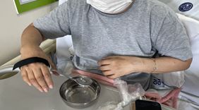 식사 보조기기 제작사례